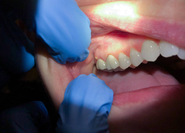 Best Emergency Dental Filling Replacement  in Mackinac Island, MI