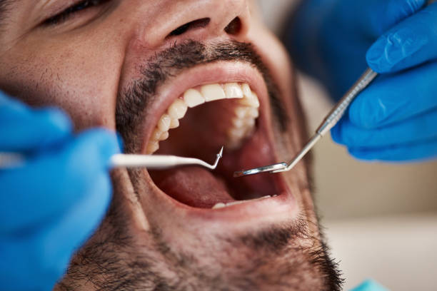 Best Dentist for Tooth Abscess  in Mackinac Island, MI