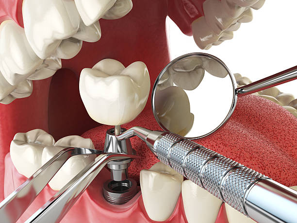 Best Urgent Tooth Repair  in Mackinac Island, MI
